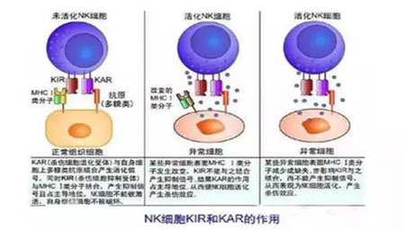 NK细胞——你的免疫系统中的先锋队-3-1.jpg